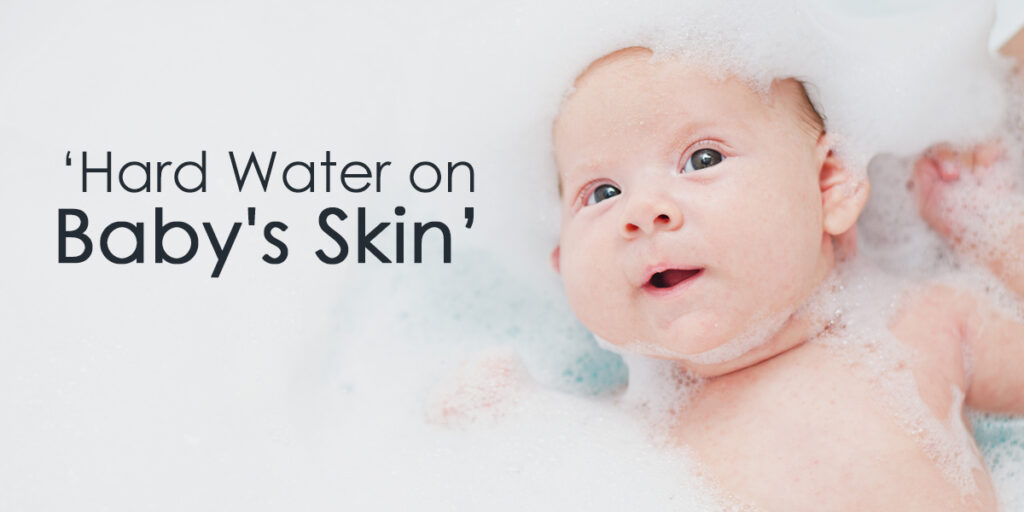 How Hard Water Can Affect Your Baby’s Skin?